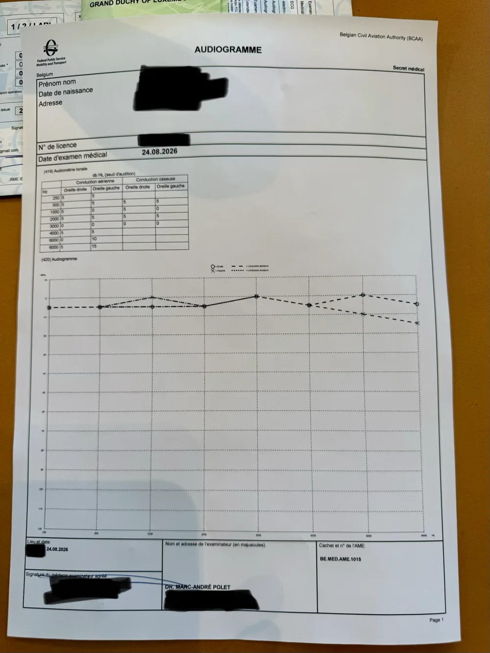 Official Belgian audiogram: threshold table by frequency and curve